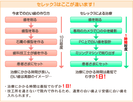 セレック3はここが違います!